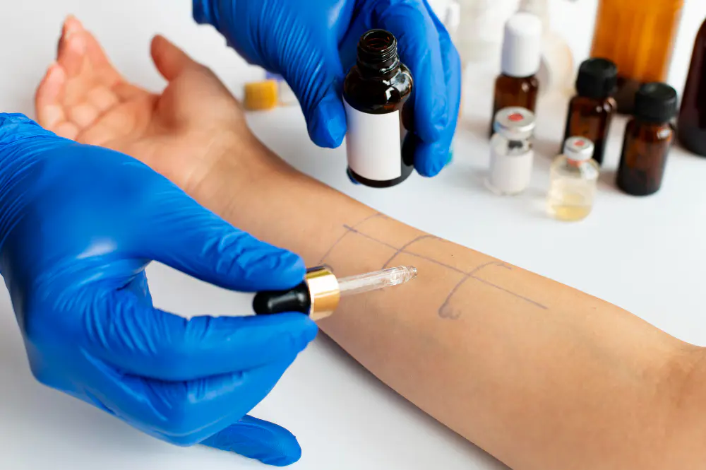 Skin Testing for Environmental Allergies