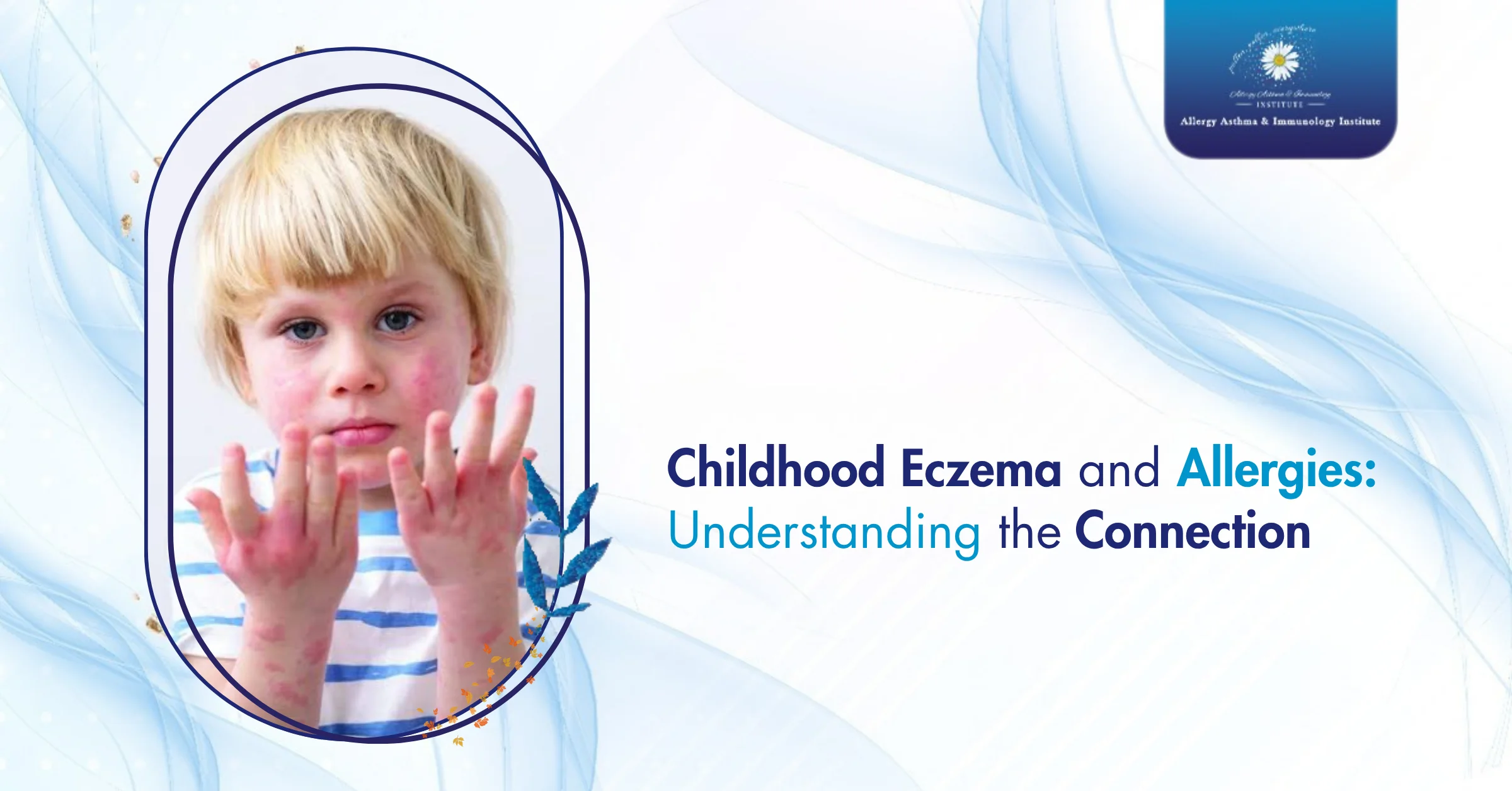 Childhood Eczema and Allergies: Understanding the Atopic March
